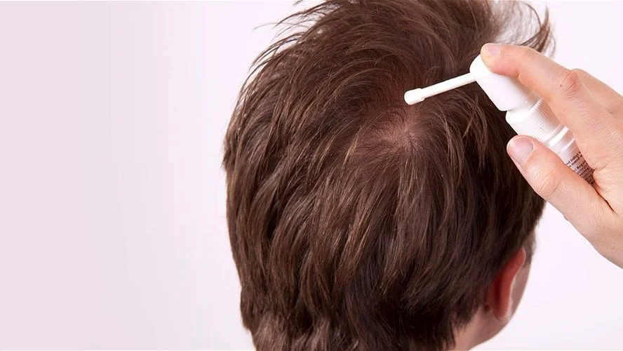 Minoxidil 5% Repousse rapide des Cheveux et Barbe 3x60ml + 1 Dermaroller